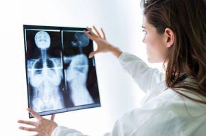 Detección del cáncer de mama